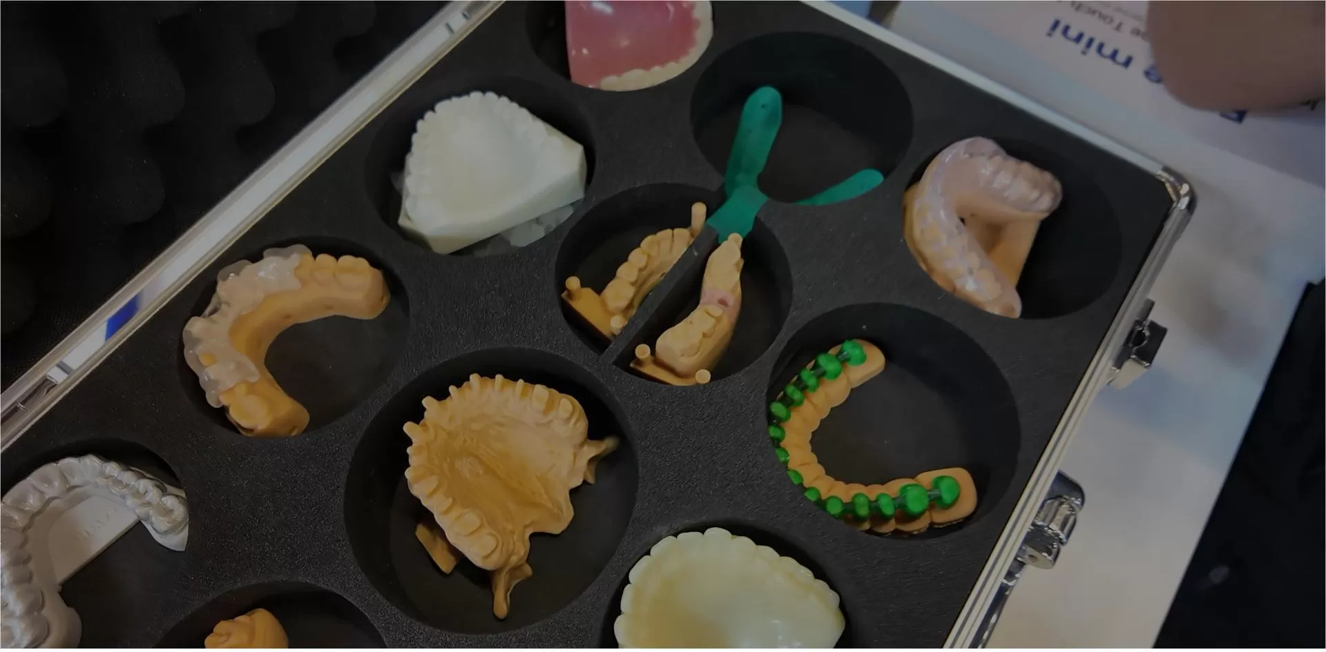 Son haberler ve Blog