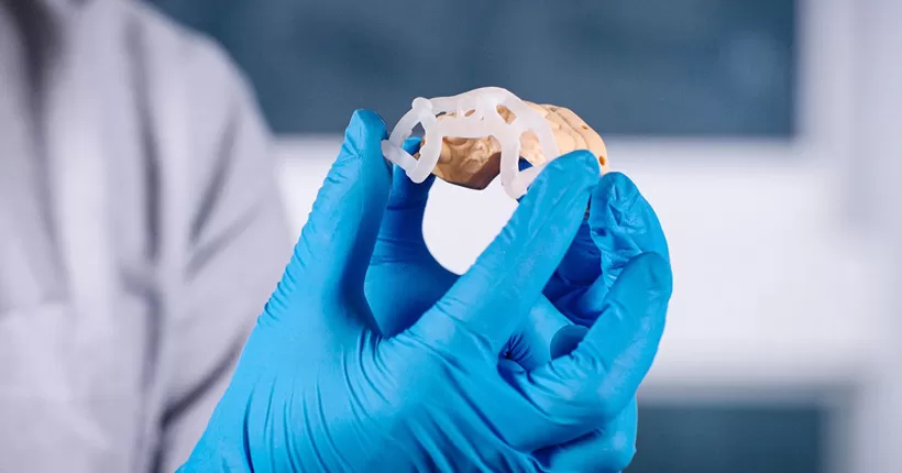 Hassas cerrahi kılavuzlar ve diş implantları için diş hekimliğinde reçine 3D baskı